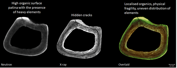 Three roughly circular cross-sections through a bone, highlighting different features such as organic content and hidden cracks